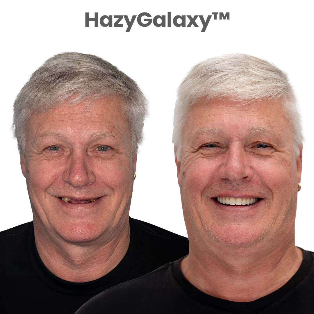 🔥HazyGalaxy™ Custom-Fit Dentures ⏰ ENDS TODAY 70% OFF | Smile with Confidence