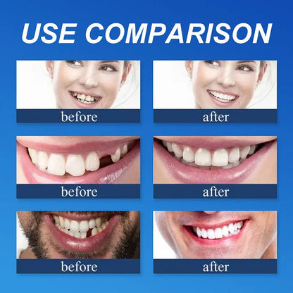 ⏰Ends Today: 75% OFF!⏰  Strong adsorption 🦷