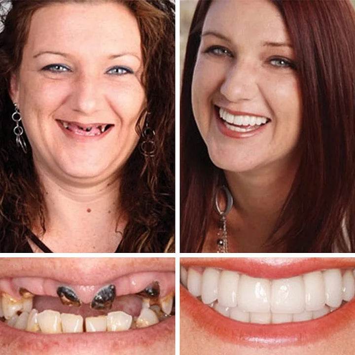 🦷  𝐈𝐦𝐦𝐞𝐝𝐢𝐚𝐭𝐞 𝐝𝐞𝐧𝐭𝐮𝐫𝐞𝐬 - 𝐰𝐞𝐚𝐫𝐚𝐛𝐥𝐞 𝐢𝐧 𝐣𝐮𝐬𝐭 𝐭𝐡𝐫𝐞𝐞 𝐦𝐢𝐧𝐮𝐭𝐞𝐬 | 𝐒𝐦𝐢𝐥𝐞 𝐰𝐢𝐭𝐡 𝐂𝐨𝐧𝐟𝐢𝐝𝐞𝐧𝐜𝐞🔥