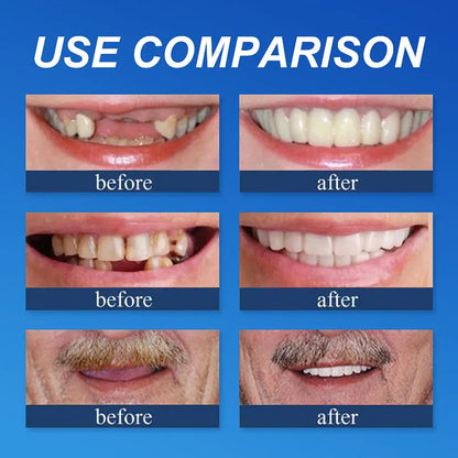 ⏰Ends Today: 75% OFF!⏰  Strong adsorption 🦷